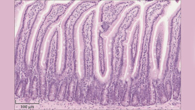 Hämatoxylin-Eosin-Färbung