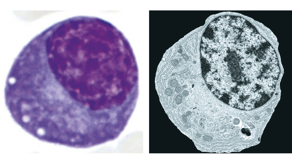 Zytologie Plasmazellen