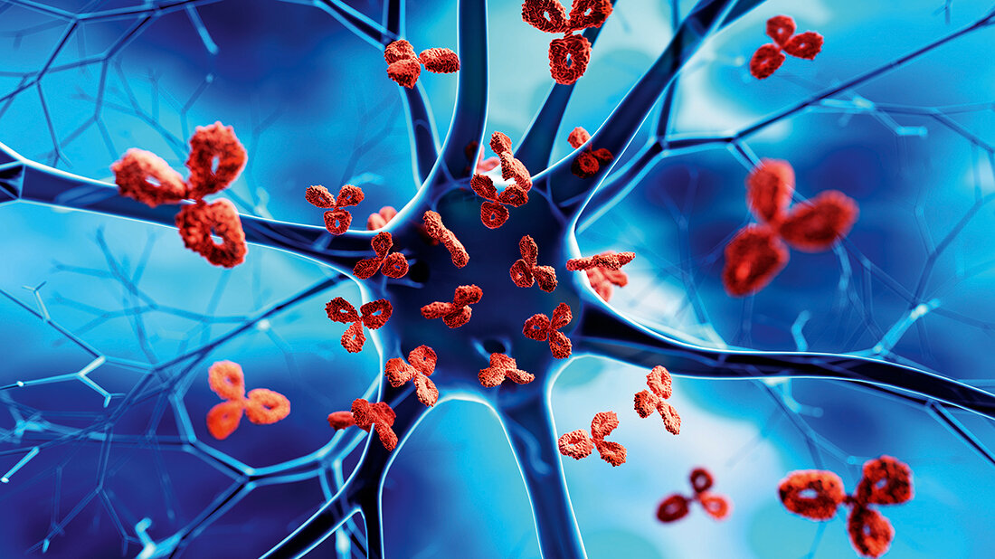 Darstellung von Antikörpern, die Nervenzellen angreifen – anschauliche Erklärung autoimmuner Prozesse im Nervensystem