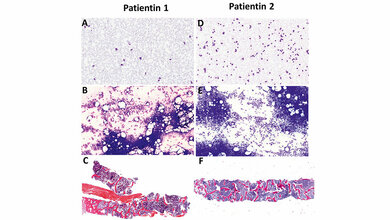 Bild 1 des Beitrags zu Weiterbildungsangeboten des DIW-MTA im Bereich Hämatologie