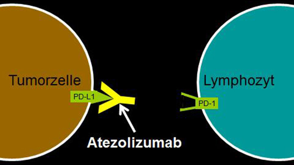 Antikörper Atezolizumab