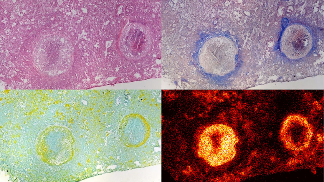 Granulomstruktur und Verteilung des Antibiotikums BTZ-043