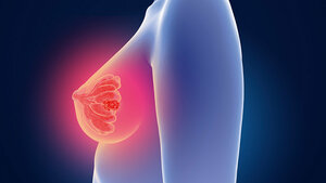 Titelbild zum Fachbeitrag über die seltene Strahlennebenwirkung BOOP