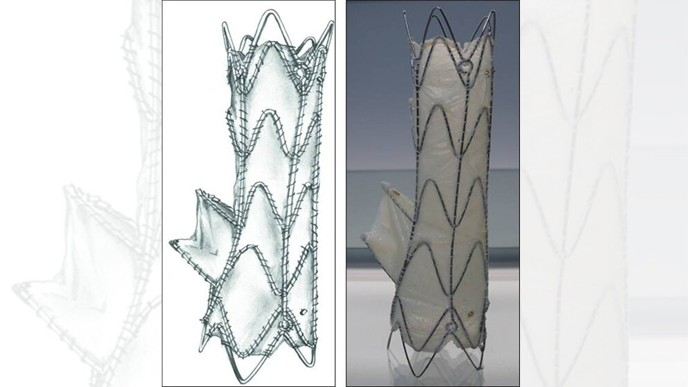 Ein winziges Röhrchen mit Ventil 