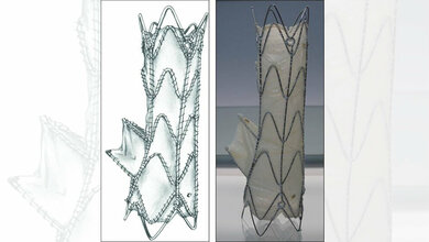 Ein winziges Röhrchen mit Ventil 