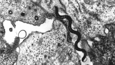 Elektronenmikroskopaufnahme Treponema