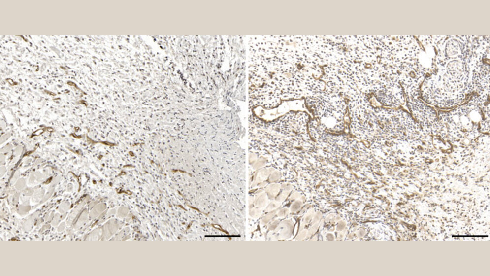 Immunhistochemische Darstellung von Blutgefäßen in Hautverletzungen 