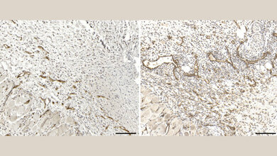Immunhistochemische Darstellung von Blutgefäßen in Hautverletzungen 