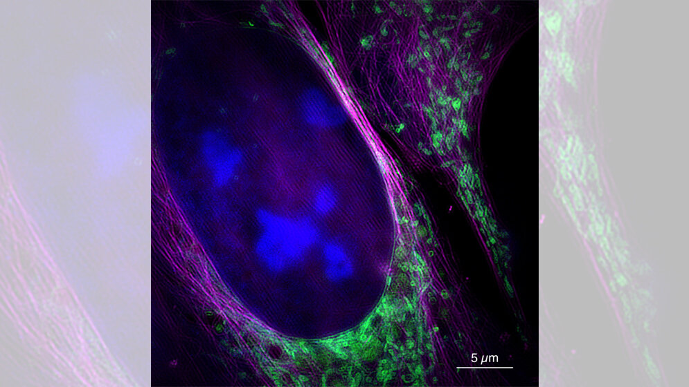 Aufnahme des neuen Mikroskops