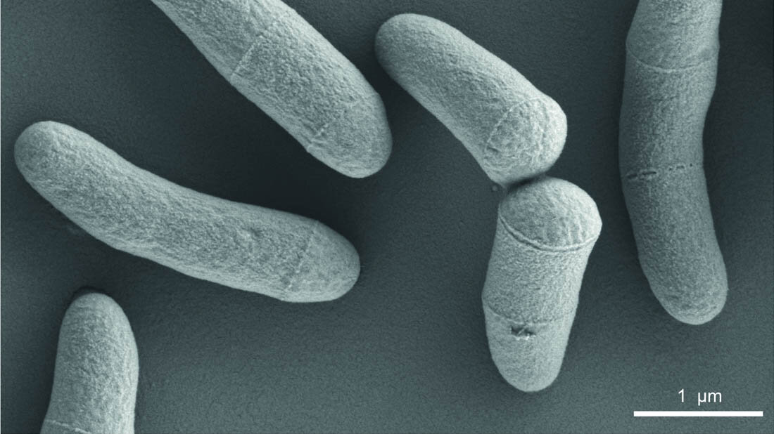 Corynebacterium glutamicum im Raster-Elektronenmikroskop