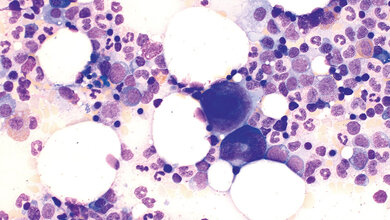 Zytologie Thrombopoese (Teil 1)