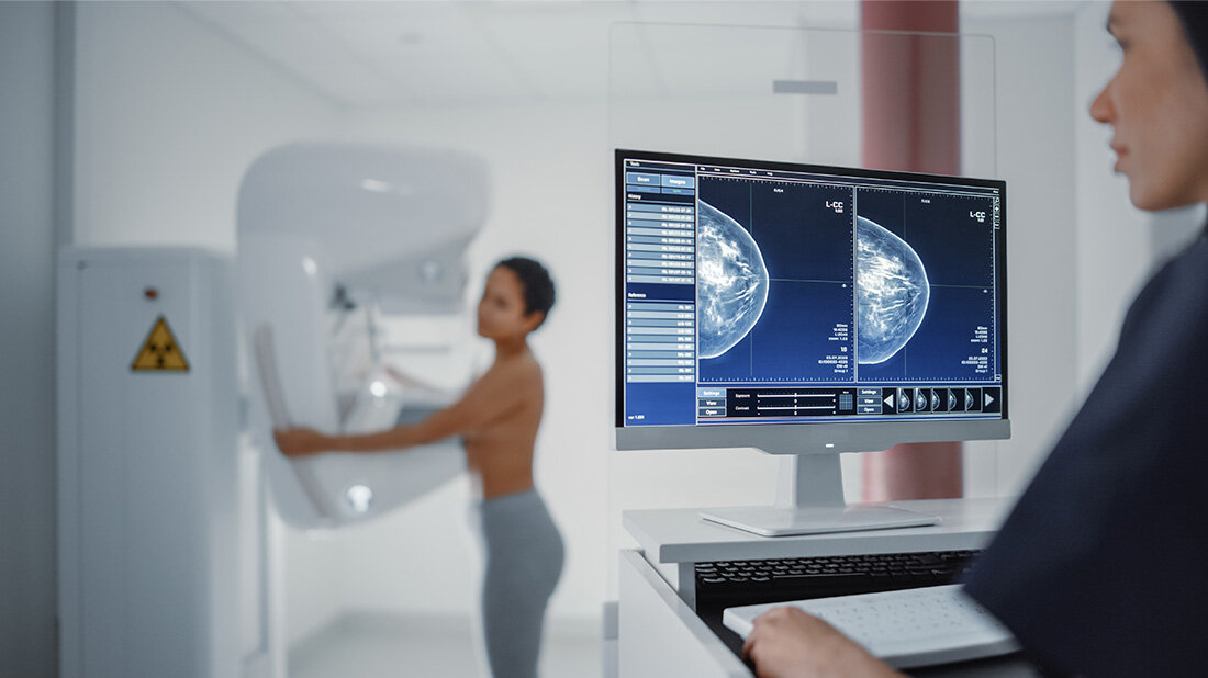 Neue EU-Empfehlung zur Krebsfrüherkennung