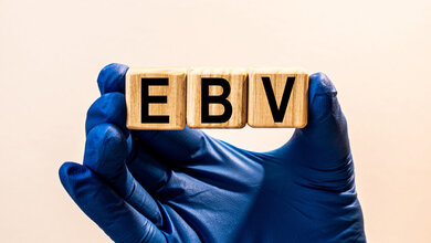 EBV.jpg EBV.jpg