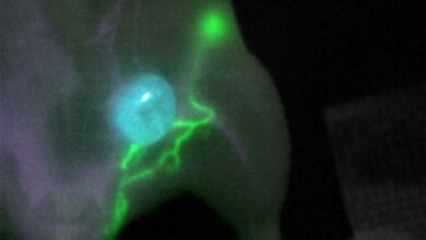 Flourose_online-1.jpg Fluoreszenzbildgebung mit kurzwelligem Infrarotlicht kann die Präzision und Sicherheit in der Krebschirurgie deutlich erhöhen.