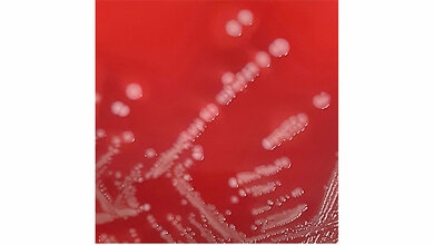 Staphylococcus aureus-Kolonien 