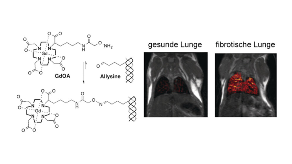 Magnetresonanzspektroskopie