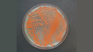 Reinkultur der Roten Hefe Rhodotorula mucilaginosa