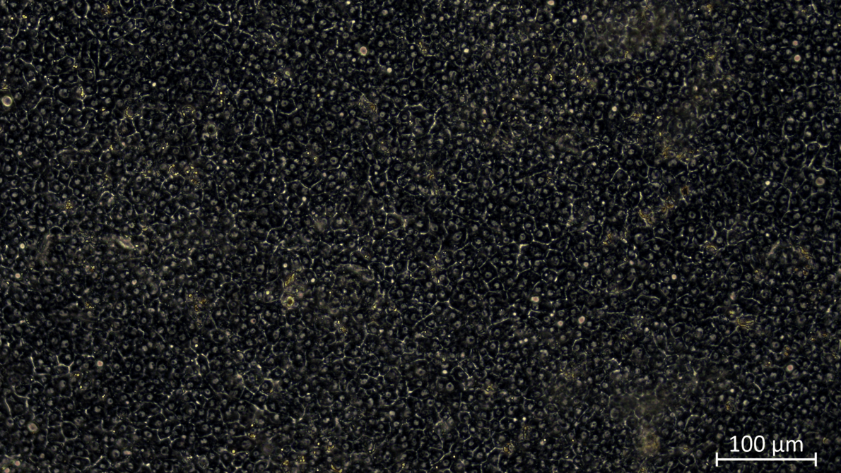 Mikroskopische Aufnahme von Zellstrukturen, kleinen Gallenkanälen, dicht angeordnet, mit einer Maßstabsangabe von 100 µm in der unteren rechten Ecke.