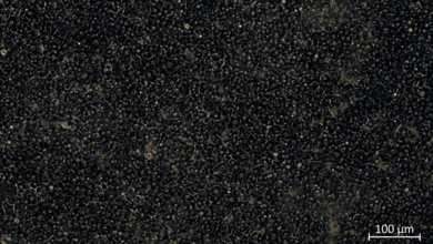 Mikroskopische Aufnahme von Zellstrukturen, kleinen Gallenkanälen, dicht angeordnet, mit einer Maßstabsangabe von 100 µm in der unteren rechten Ecke.