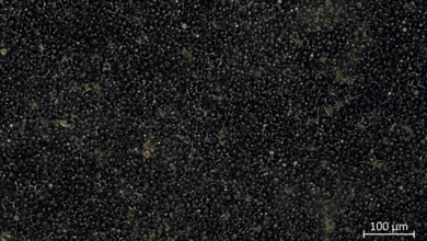 Mikroskopische Aufnahme von Zellstrukturen, kleinen Gallenkanälen, dicht angeordnet, mit einer Maßstabsangabe von 100 µm in der unteren rechten Ecke.