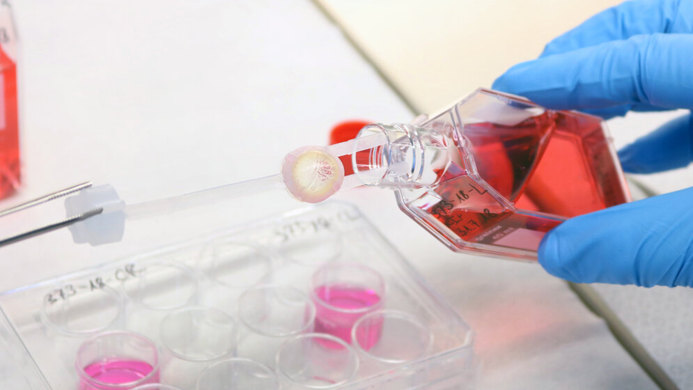 Rund 90 Prozent der gespendeten Gewebe 2019 waren Augenhornhäute.