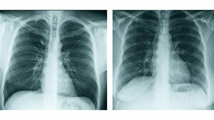 Anomalien und Normvarianten