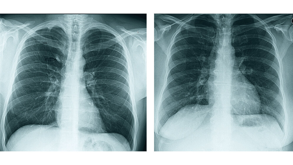 Anomalien und Normvarianten