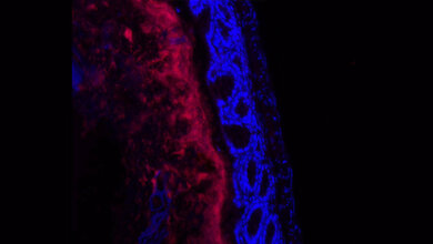 Mikrobiota des Darms