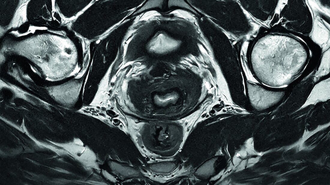 MR-Aufnahme des Beckens
