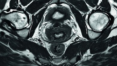 MR-Aufnahme des Beckens