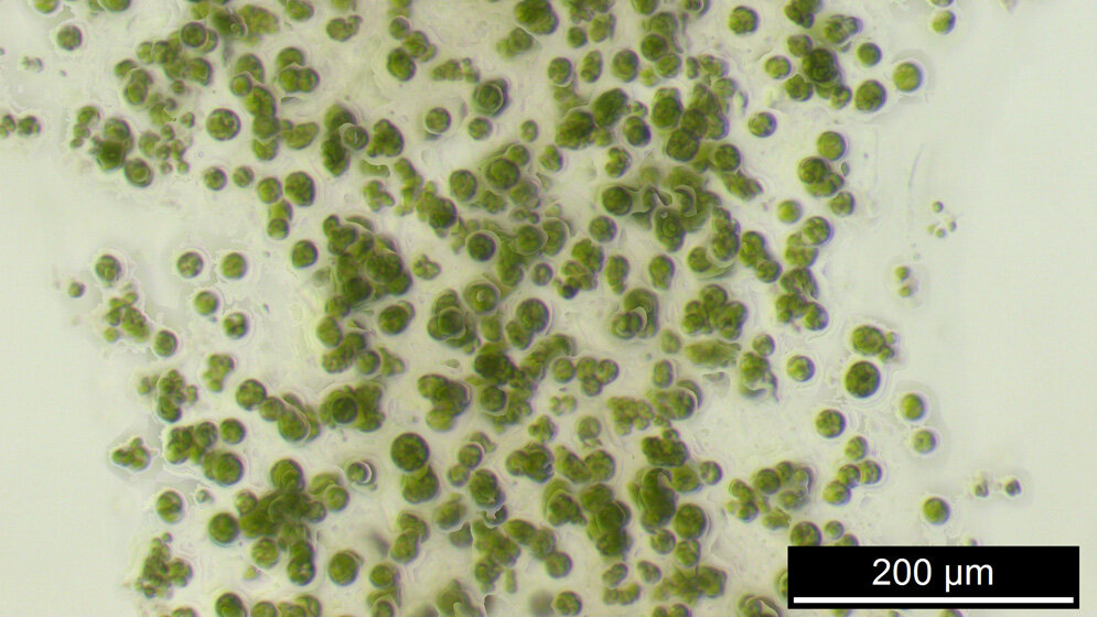 Mikroskopische Aufnahme einer Mikroalge