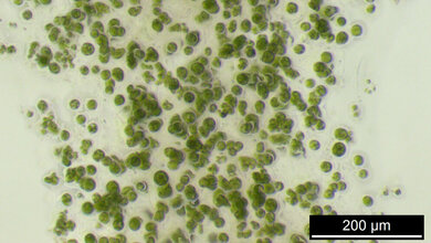 Mikroskopische Aufnahme einer Mikroalge