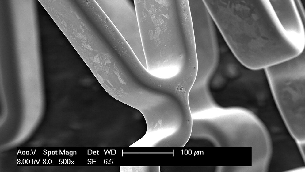 Mit Titanoxinitrid beschichteter Stent