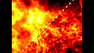 Einsatz_von_KI.jpg Ein Fluoreszenzmikroskopiebild aus dem BioSR-Datensatz für die hochauflösende Mikroskopie