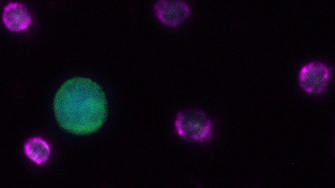 Zirkulierende_Tumorzelle.jpg Zirkulierende Tumorzelle