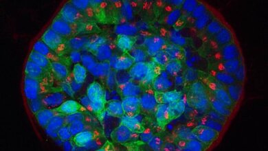 Brustzellen in 3D Zellkultur gewachsen