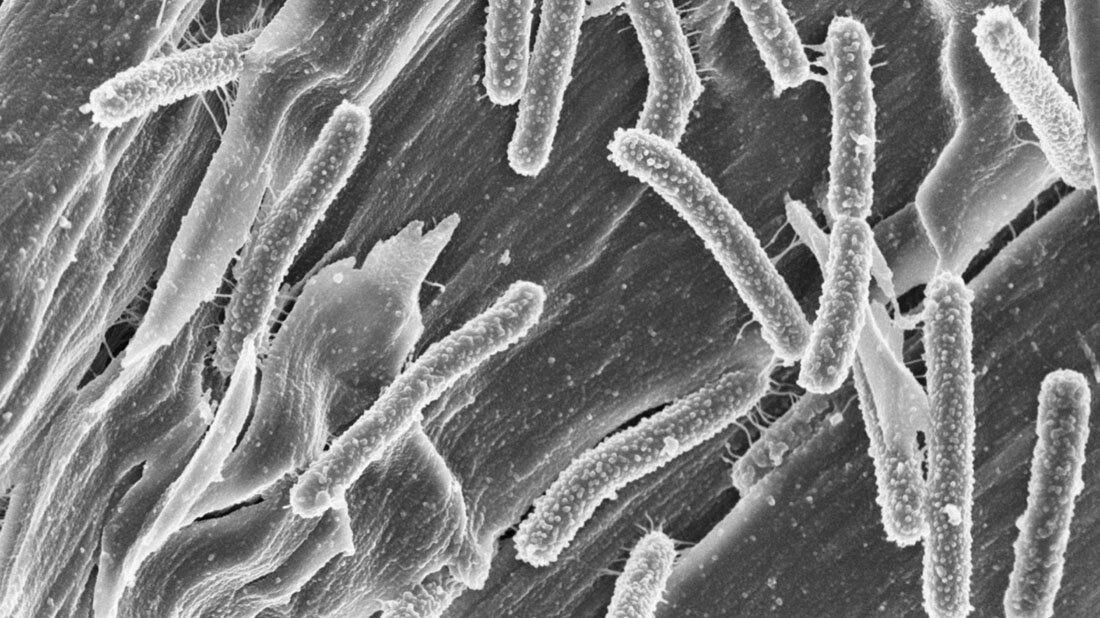 Clostridium clariflavum