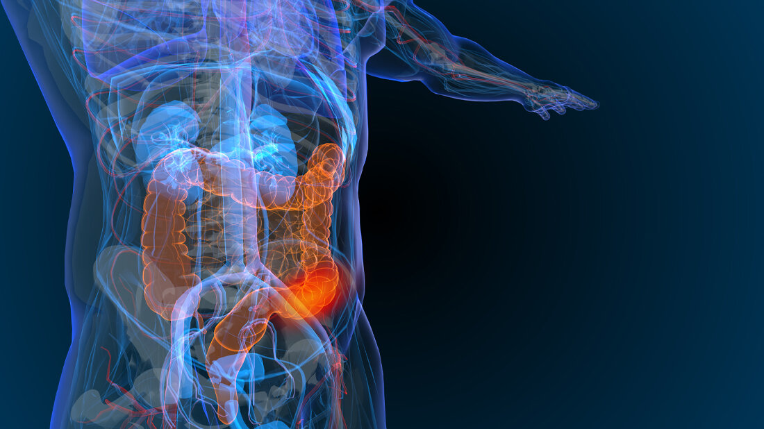 Darmkrebsvorsorge_01.jpg Darmkrebsvorsorge