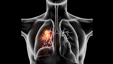 Label-freie digitale Pathologie