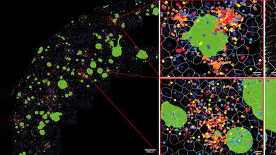 Mikroskopische Darstellung von T-Zellen, grüne Flecken (Amyloid-Beta-Ablagerungen) mit bunten Flecken (lokale Botenstoffe) drum herum