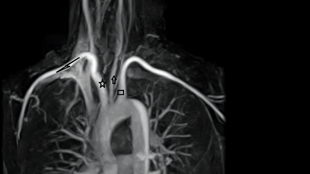 Anomalien und Normvarianten