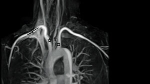 Anomalien und Normvarianten