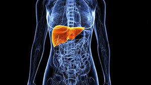 Hepatitis C