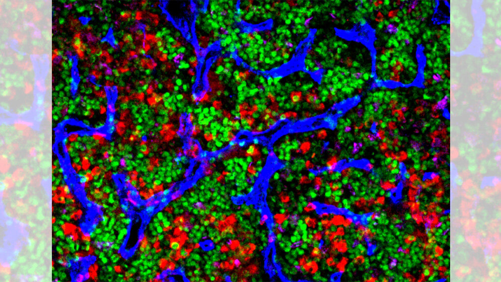 Mikroskop. Aufnahme von altem Knochenmark