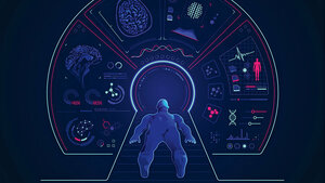 Artificial Intelligence in Radiology