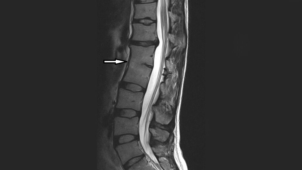 Anomalien und Normvarianten: Skelettale Veränderungen 3.14
