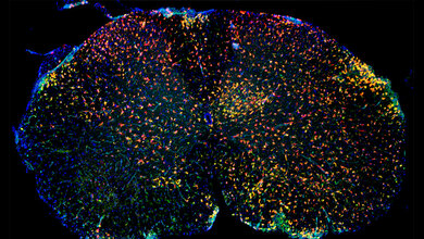 Immunfluoreszenz_von_entzuendlich_veraendertem_Rueckenmark_MJC_Jordao_Uniklinikum_Freiburg.jpg Immunfluoreszenz von entzündlich verändertem Rückenmark