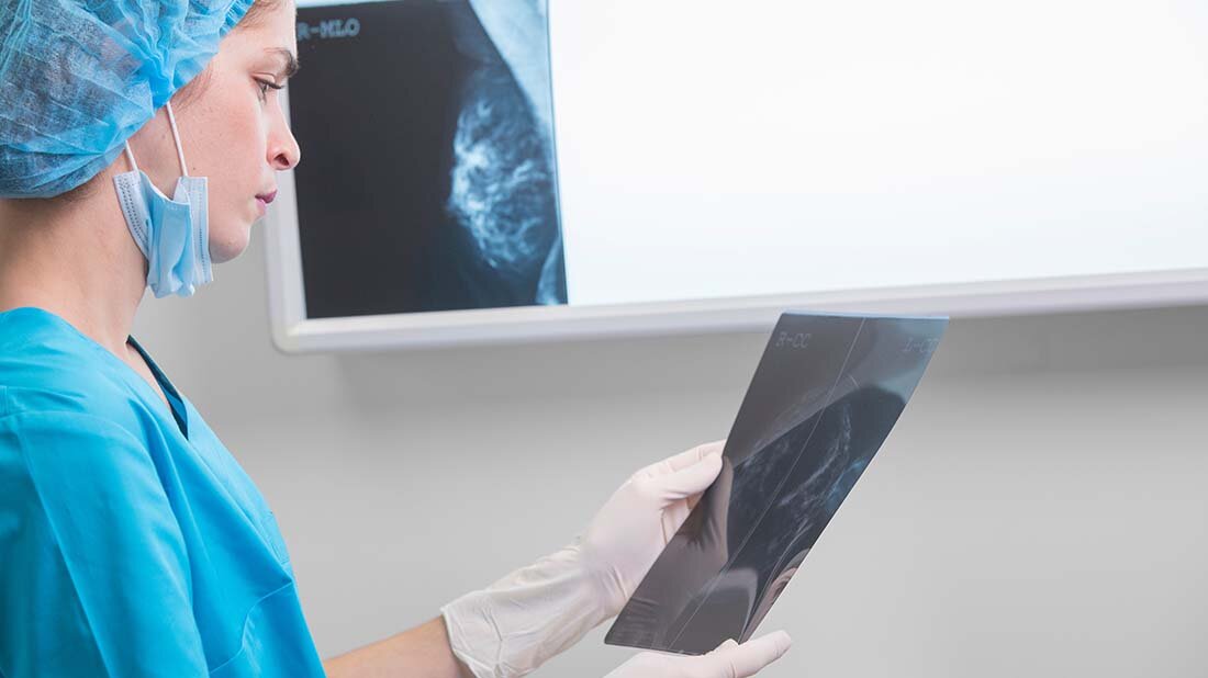 Krebsregister.jpg Zusammenführung von Krebsregisterdaten