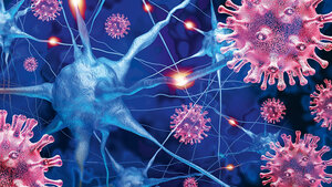 Titelbild des englischsprachigen Beitrags über Neuroinfektionen