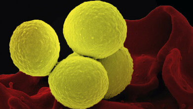 Sepsis verursacht durch Enterobakterien oder Staphylococcus aureus